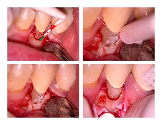 root resorption_Page3.jpg